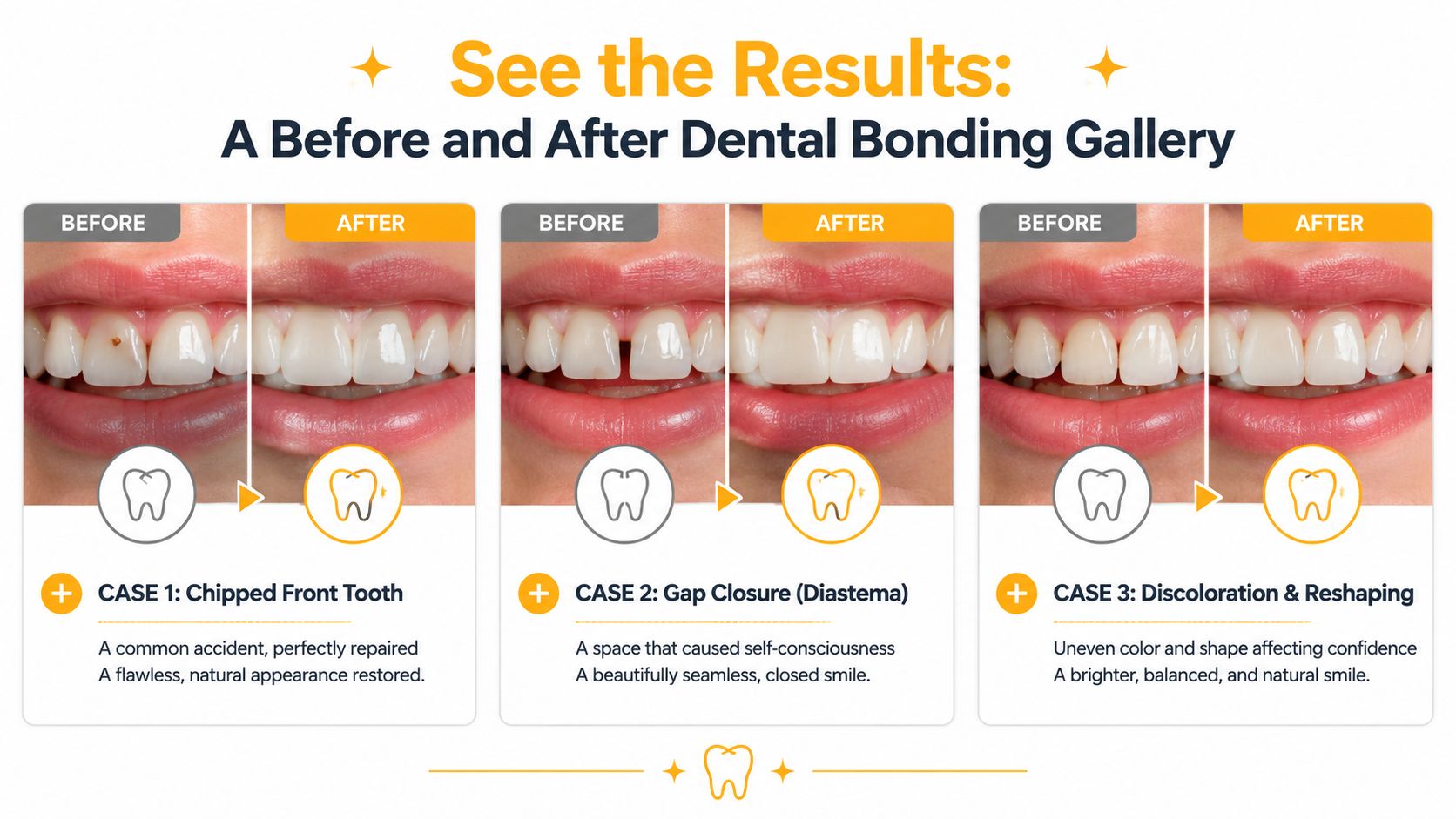 A gallery showing three sets of before and after dental bonding procedures for various cosmetic dental issues.