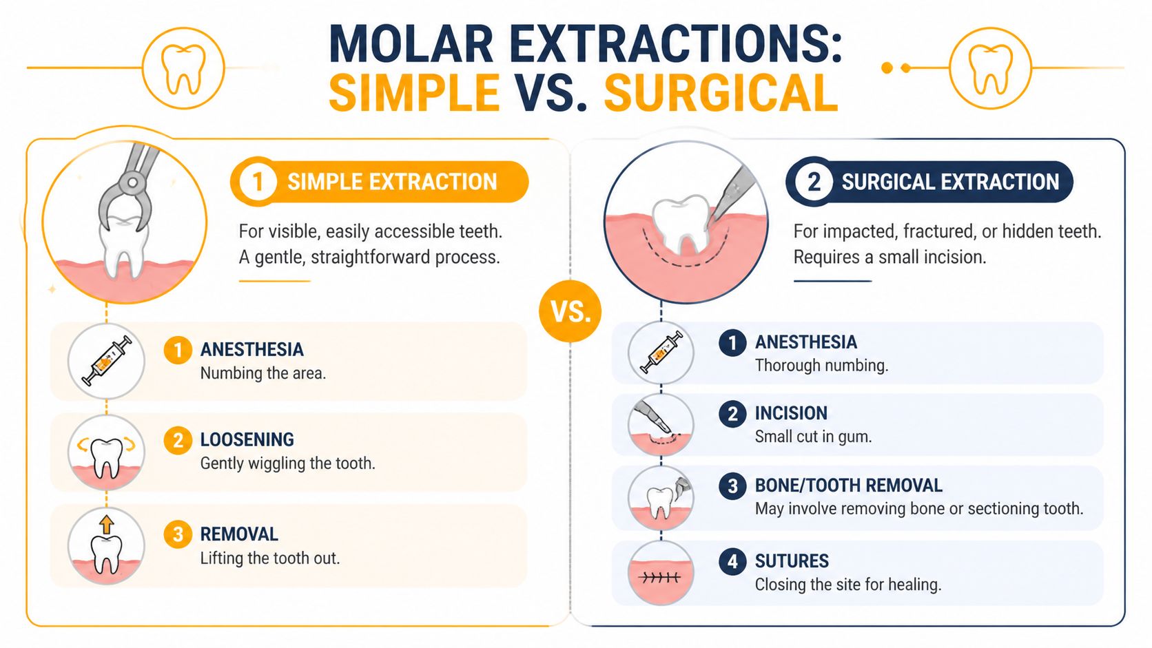 An infographic comparing the simple dental extraction process versus the surgical molar extraction procedure with step-by-step illustrations.