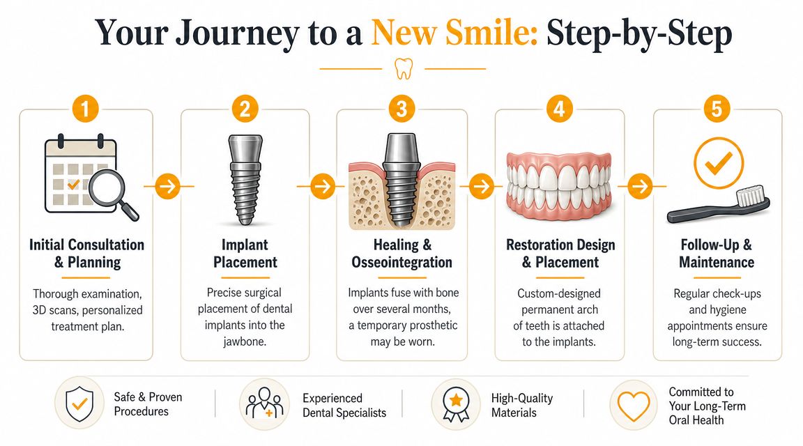 A step-by-step infographic showing the five stages of receiving full arch dental implants for a new smile.