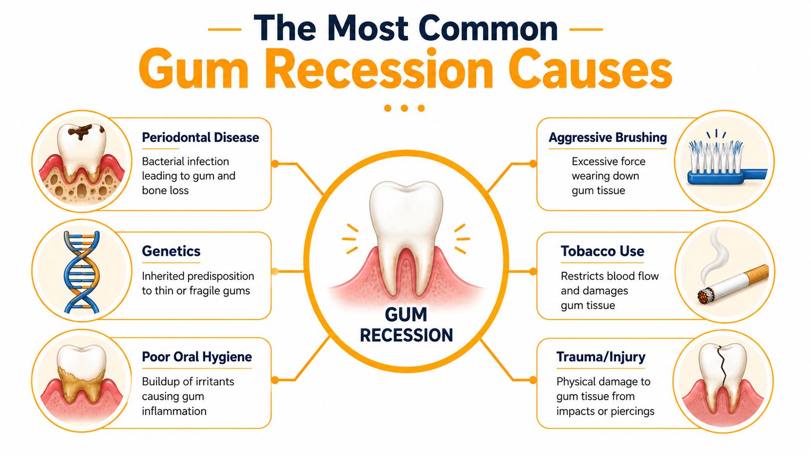 An infographic showing six primary causes of gum recession, including disease, genetics, hygiene, brushing, tobacco, and injury.
