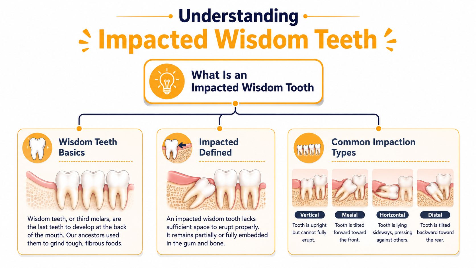 An educational infographic explaining the definitions and common types of impacted wisdom teeth in human mouths.