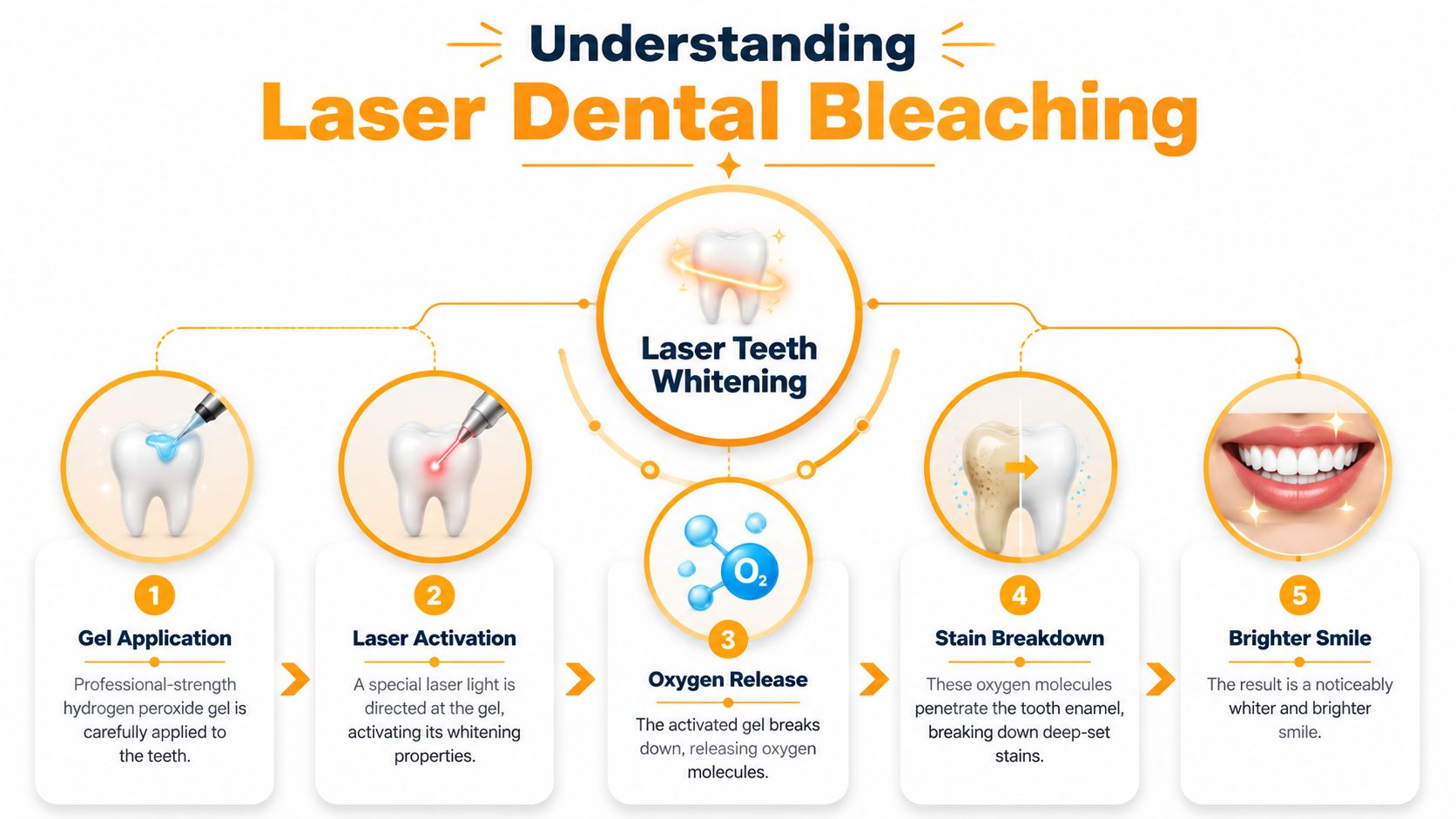 A step-by-step infographic illustrating the professional laser dental bleaching process for a brighter smile.