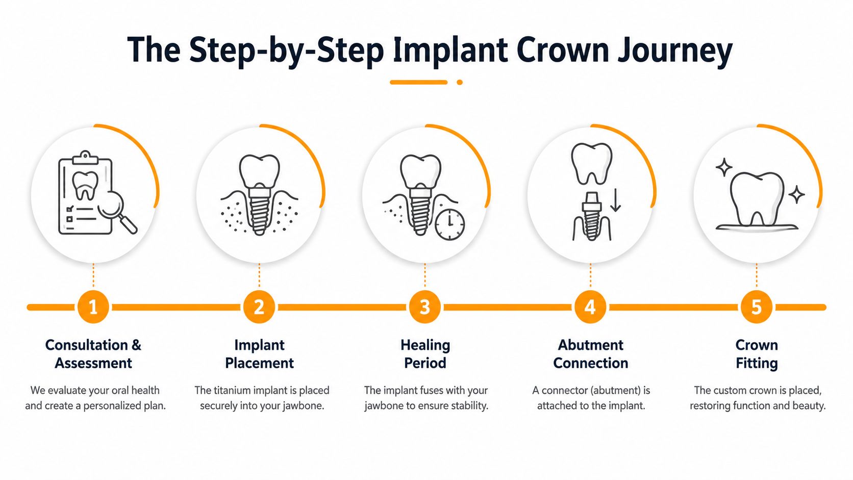 A five-step infographic showing the dental implant crown procedure from initial consultation to final crown placement.