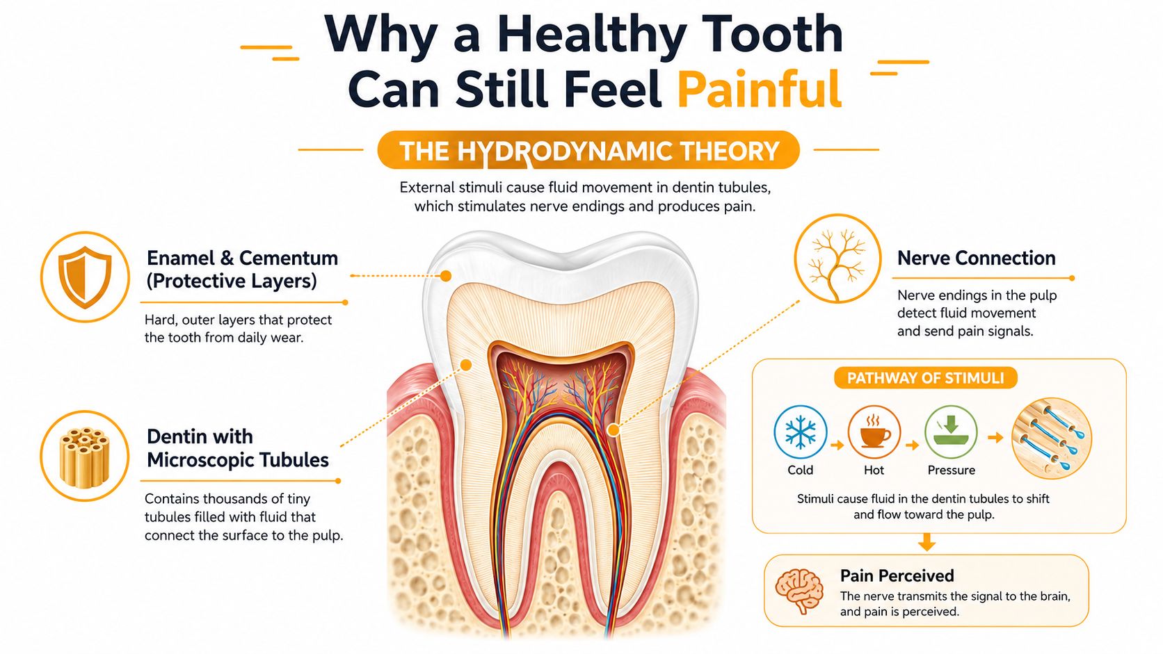A diagram explaining the hydrodynamic theory of tooth sensitivity using an anatomical cross-section of a human tooth.