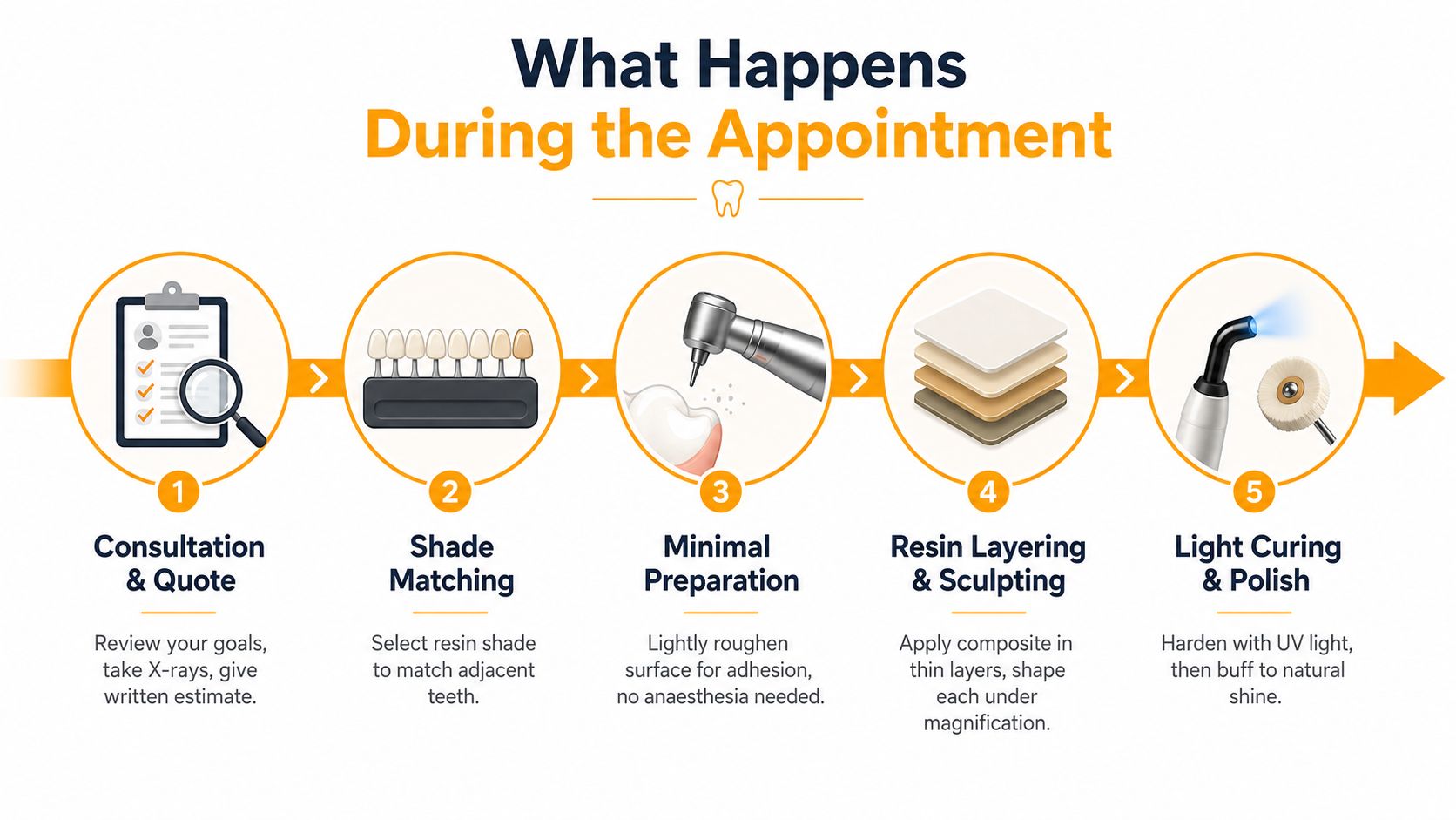 A five-step infographic illustrating the dental composite bonding procedure from consultation to the final polish.
