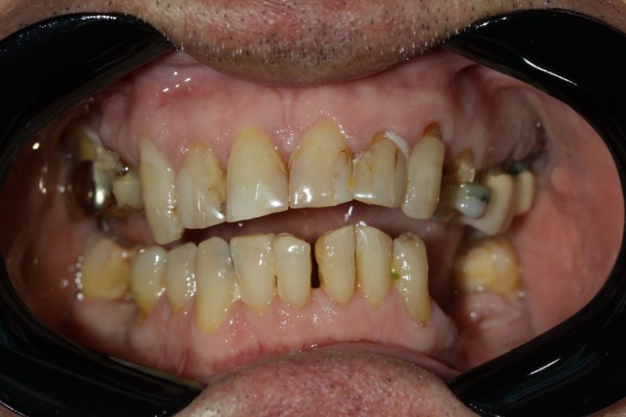 Smile-Spot-Dentistry-Con-1-1024x683