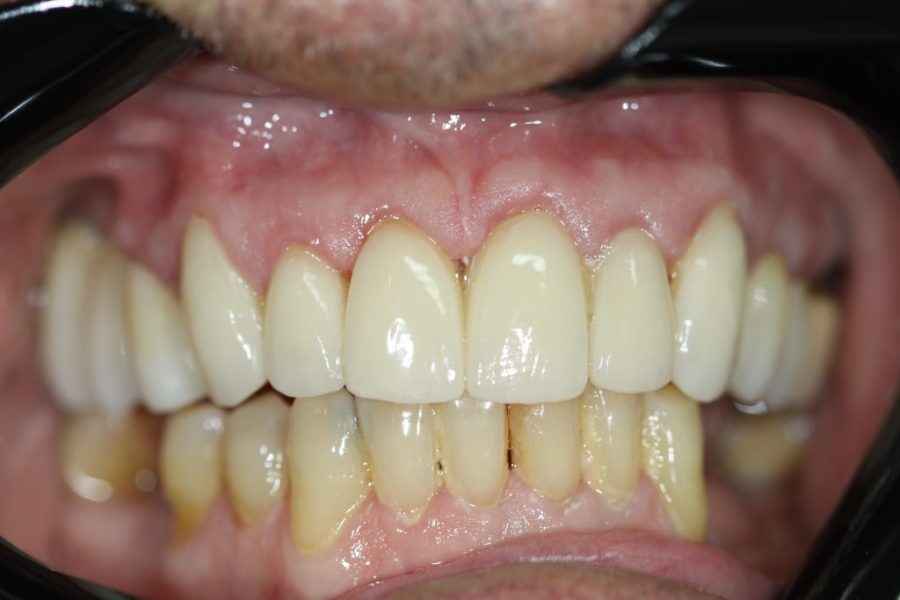 Smile-Spot-Dentistry-Con-1024x683